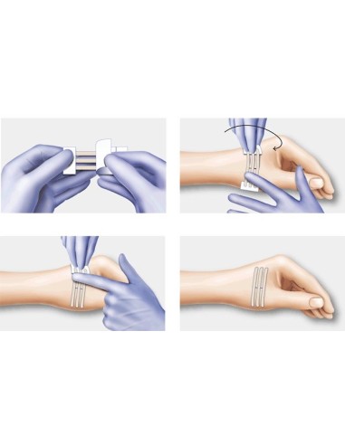 Sutura adhesiva Omnistrip [50u]
