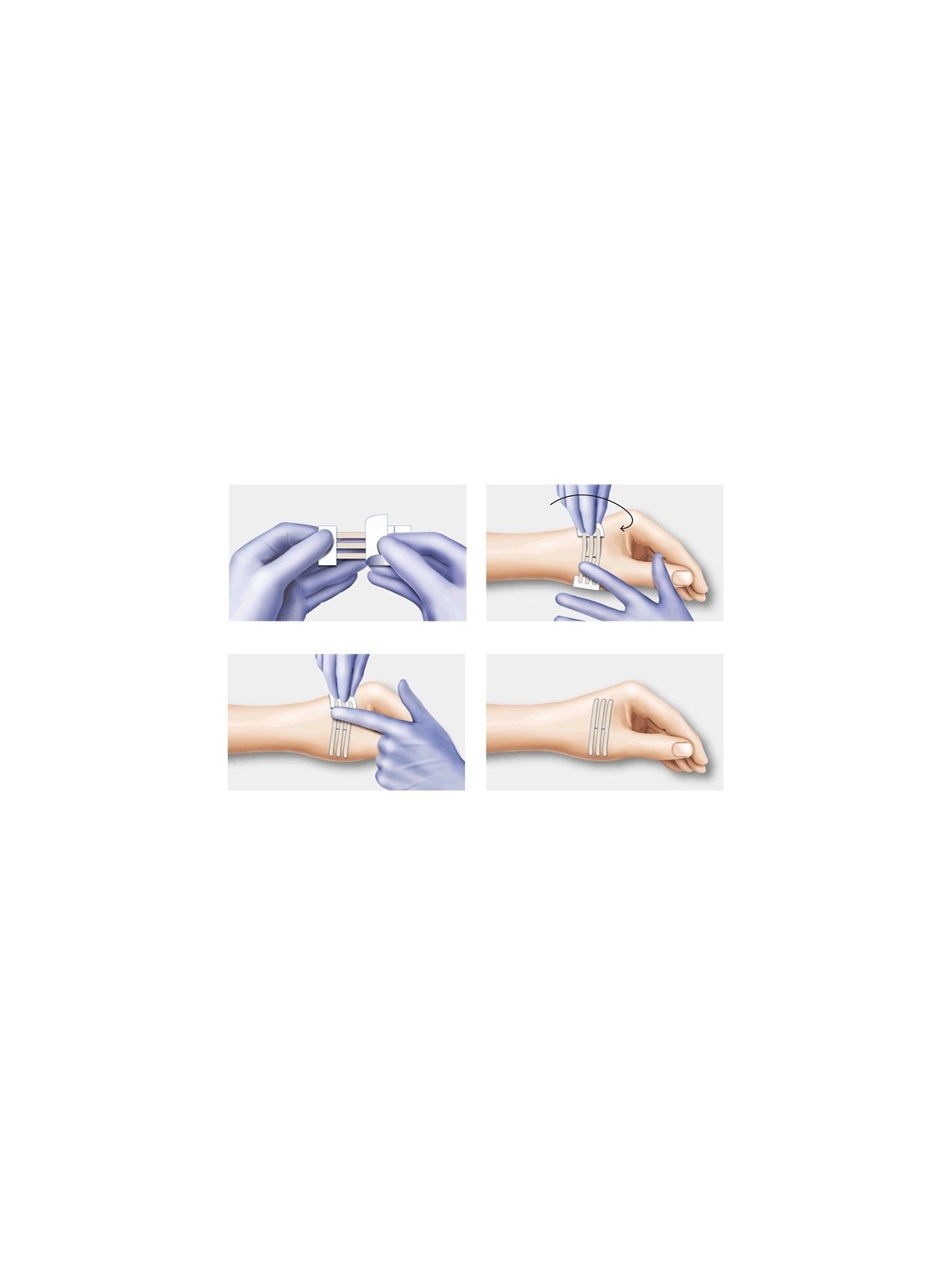 Sutura adhesiva Omnistrip [50u]