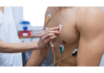¿Cómo colocar los electrodos ECG correctamente? 