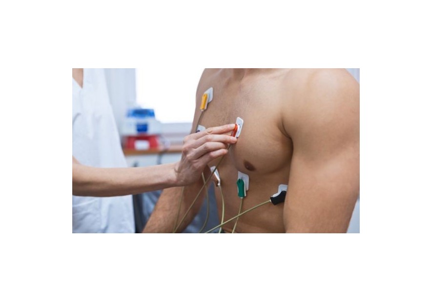 ¿Cómo colocar los electrodos ECG correctamente? ¿Cómo colocar los electrodos ECG correctamente?